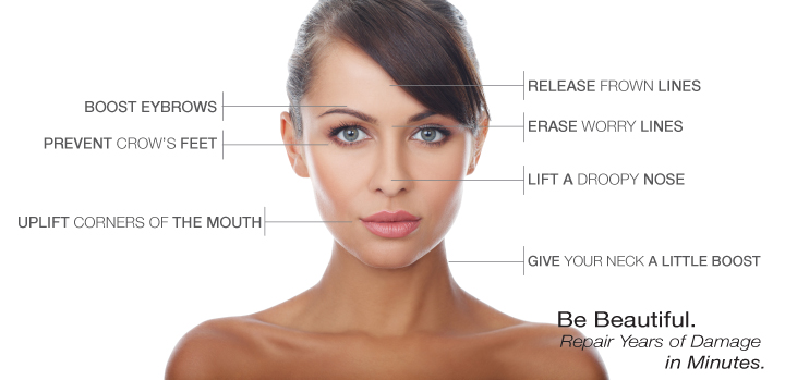 Botox-diagram