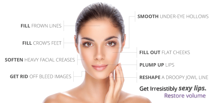 Botox & Fillers – L. Spa | Sarasota